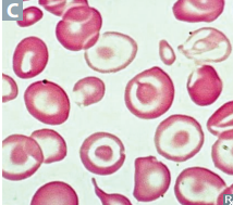 <p>Target cells</p>