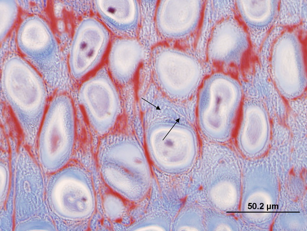 <p>name the fibers that are ‘glowing’ or refracting light</p>