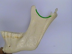 <p>Curve on the top portion of mandible between the condyle and the coronoid process</p>