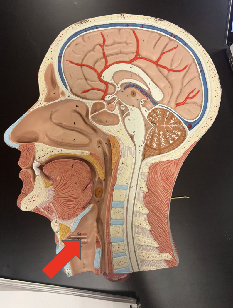 <p>This structure is the</p>
