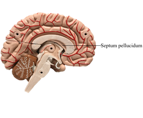 <p>Septum Pellucidum</p>