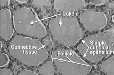 <p>What gland is this tissue from?</p>