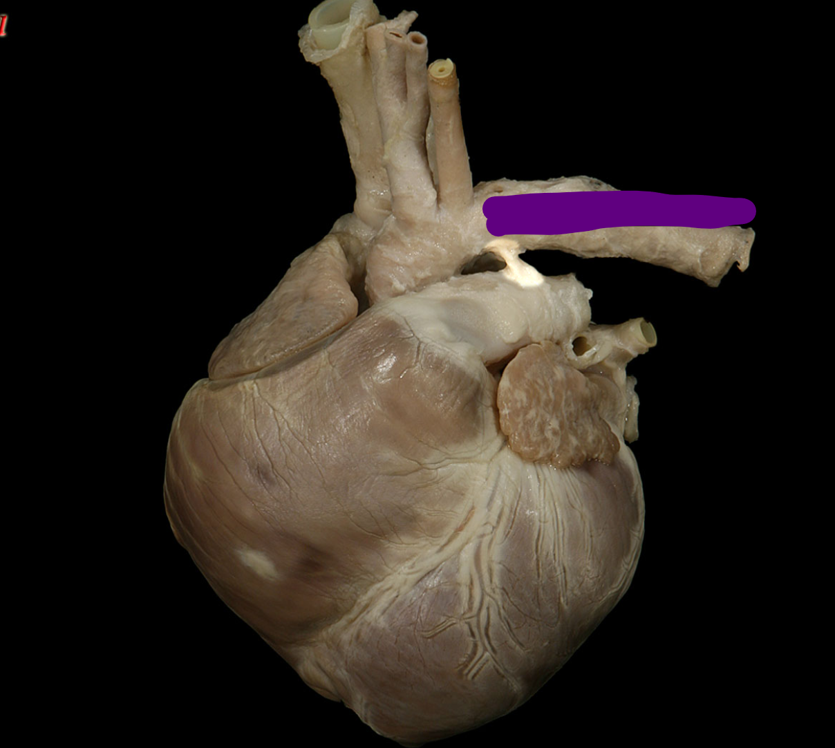 <p>Name the structure </p>