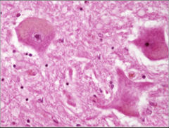 <p>What does this image show?</p>