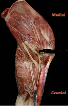 <ol><li><p>origin</p></li></ol><p>distal scapular spine</p><ol start="2"><li><p>insertion</p></li></ol><p>proximal and medical aspects of radius and ulna</p><ol start="3"><li><p>action</p></li></ol><p>flexes elbow joint</p><p>extends shoulder joint</p><p></p>