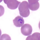<p>Ring form</p><p>6-12 merozoites</p>