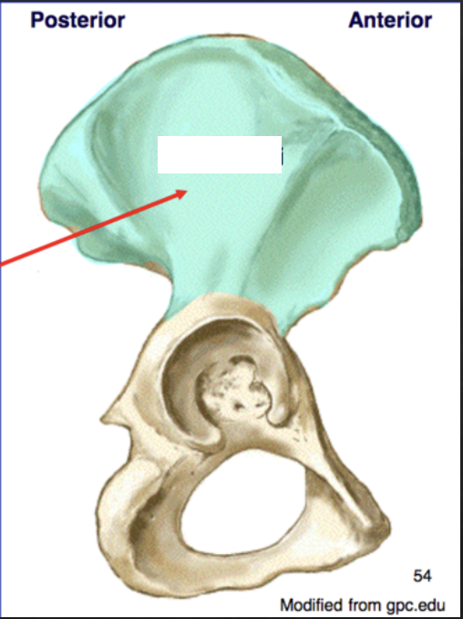 <p>Pelvis: What is the Red arrow pointing to?</p>