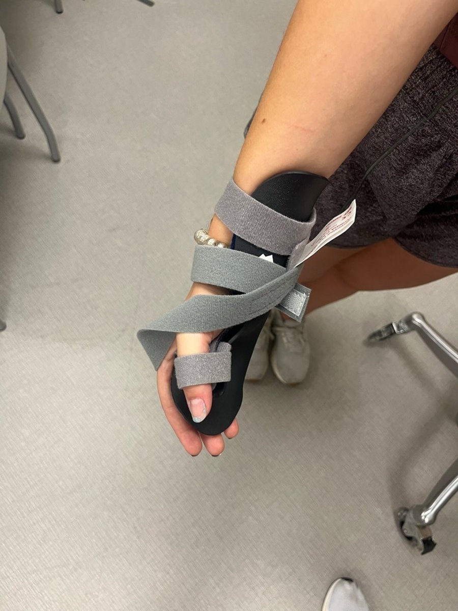 <p>**manage spasticity preserve hand function</p><p>**Stroke</p><p>*TBI, Ulnary palsy, post op tendon repair</p>