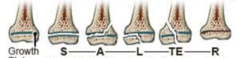 <p>S-traight across</p><p>A-bove</p><p>L-lower</p><p>TE-Through Everything</p><p>c-R-ush</p>