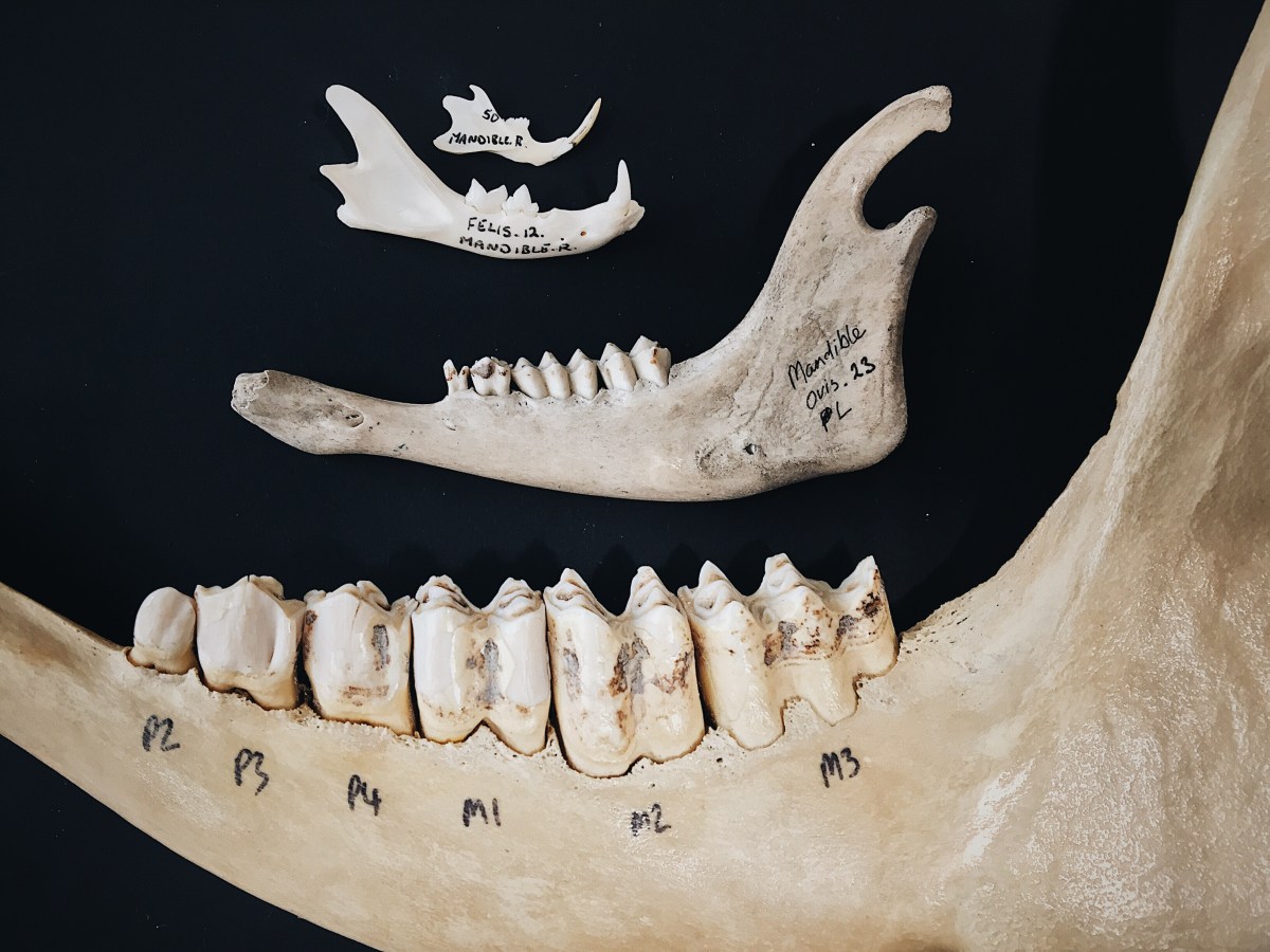 <p>Mandible</p>