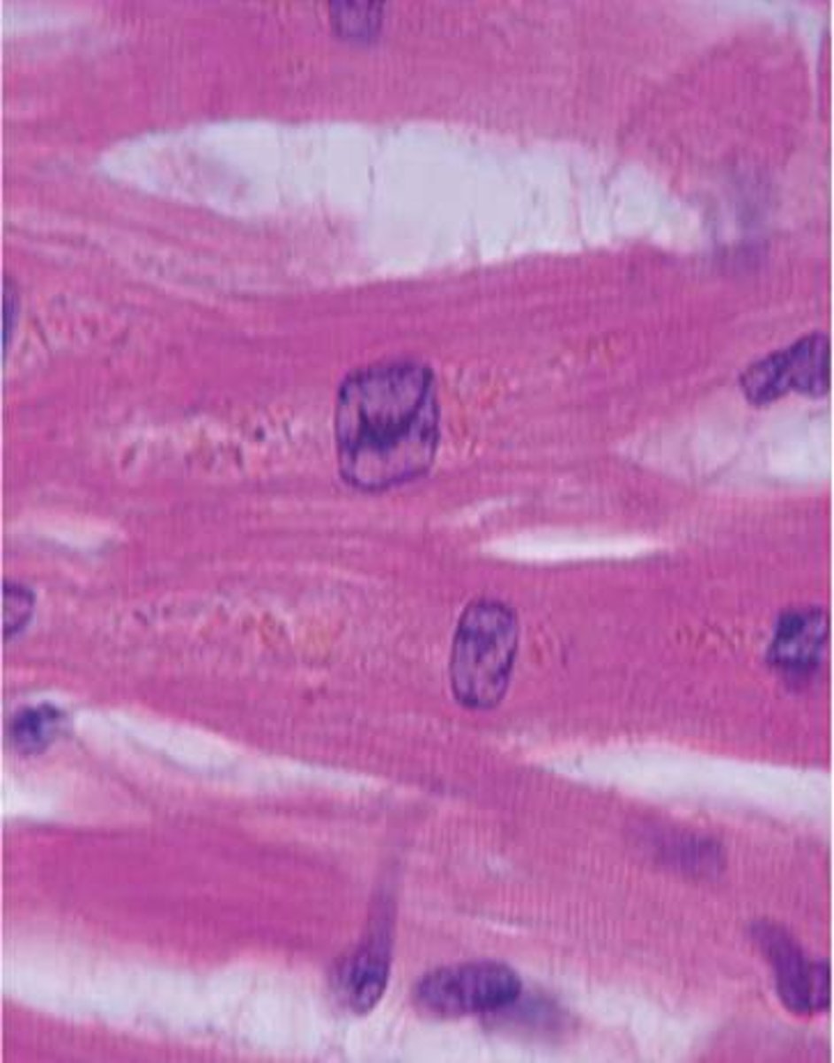<p>Highly branching and look a lot "messier" than skeletal muscle</p>
