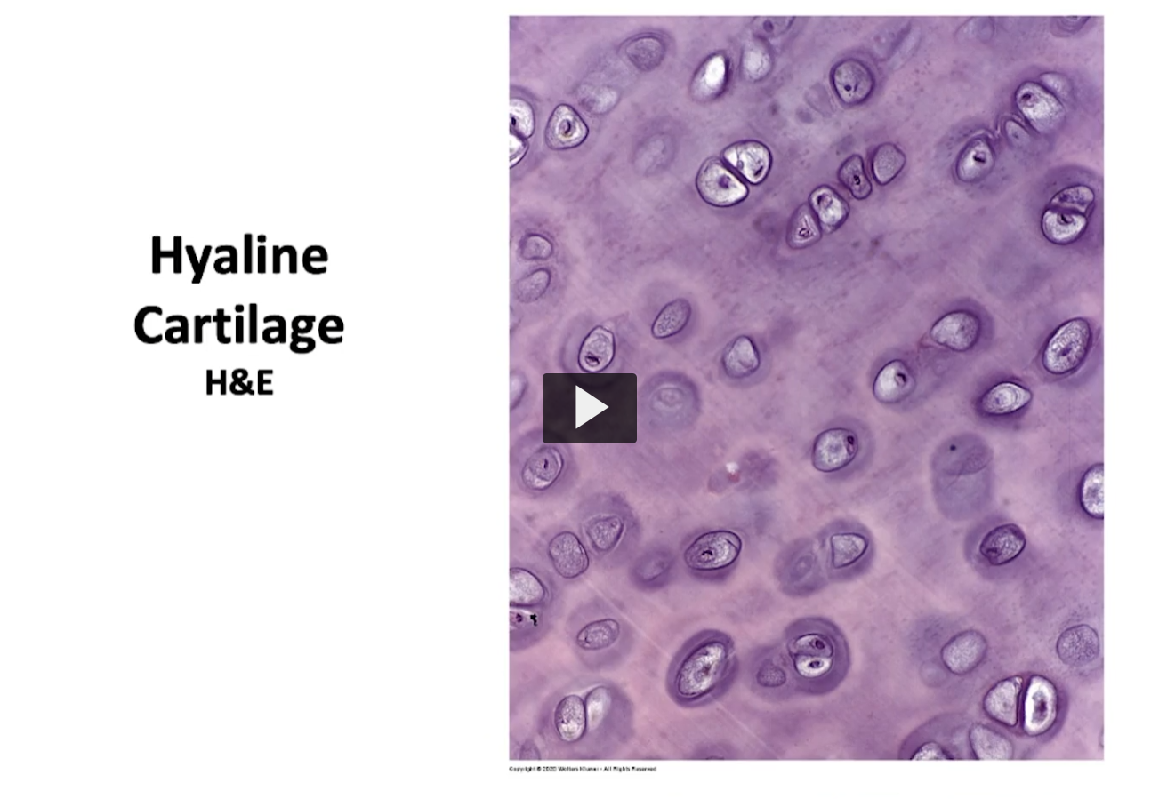 <p>If I observe the mass of tissue cartilage, this is what I observe. Since this is the center of the mass of mature cartilage, Observe the chondrocytes in their lacunae. </p>