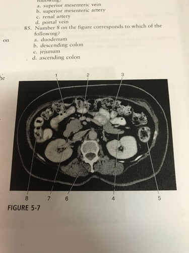 <p>Number 2 on the figure corresponds to which of the following?</p><p>A) superior mesenteric vein</p><p>B) superior mesenteric artery </p><p>C) renal artery </p><p>D) portal vein</p>