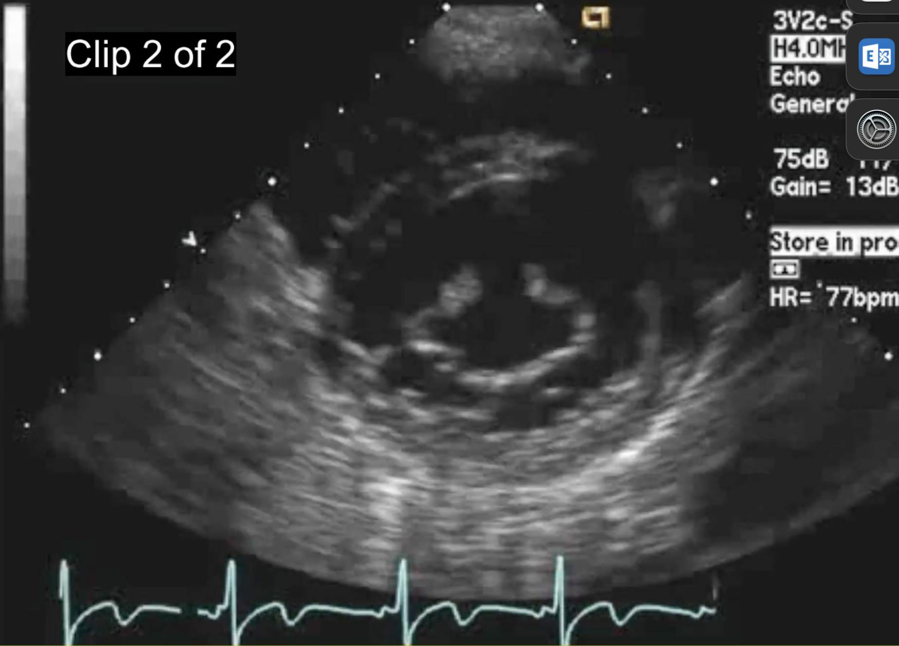 <p>What does this show? What symtoms</p>