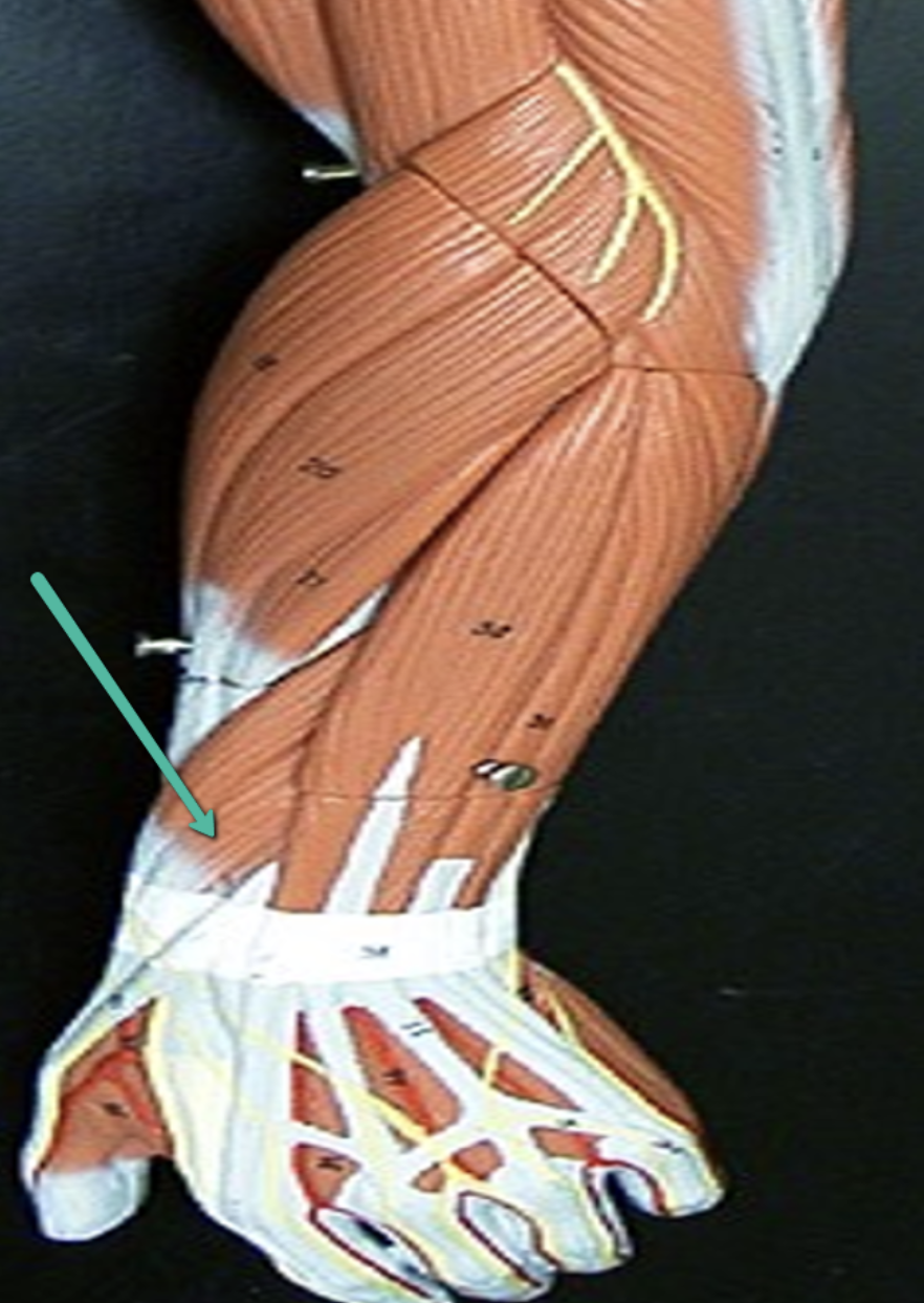 <p>Identify the muscle indicated by the pointer.</p>