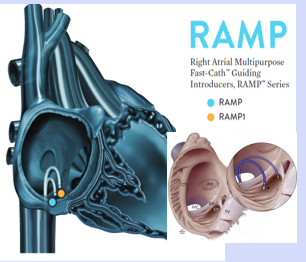 <p>RAMP (right sided)</p>