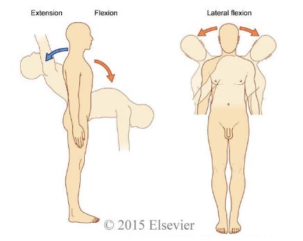 <p>extension </p>