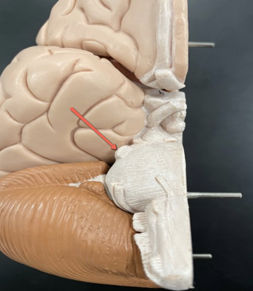 <p><span><strong>Identify the cranial nerve indicated by the pointer.</strong></span></p>