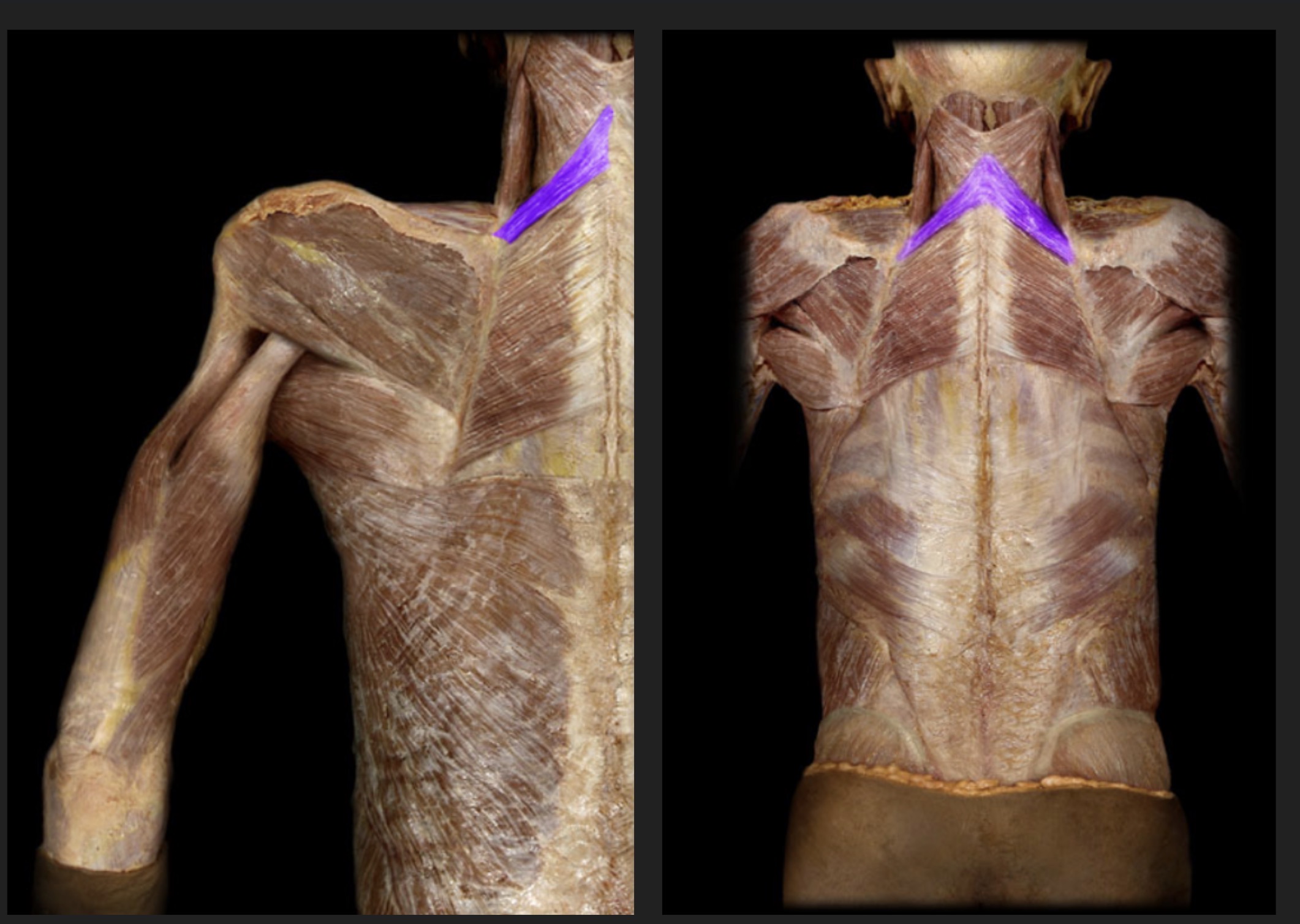 <p>Superior to rhomboid major; elevates and retracts scapula</p>