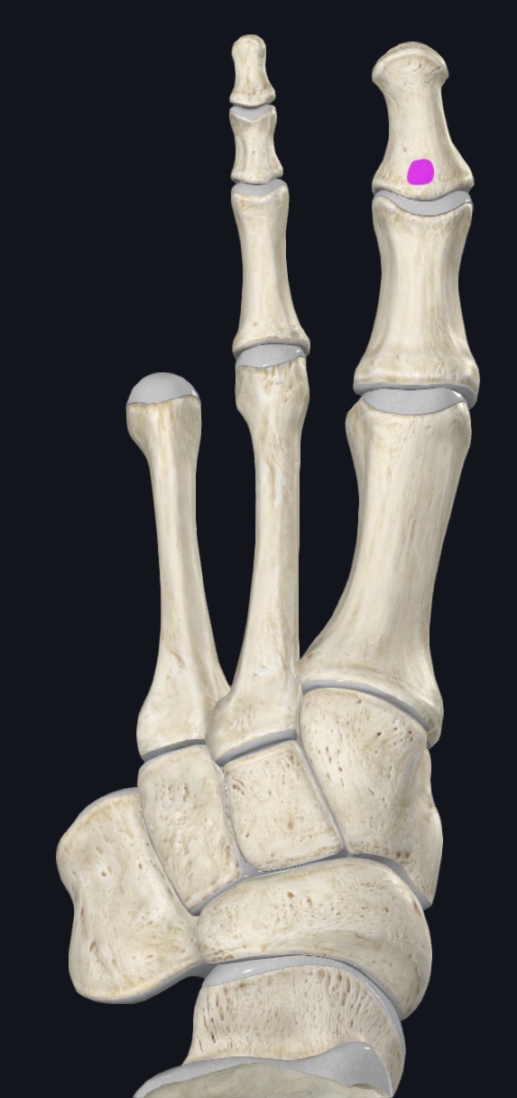 <p>Dorsal aspect of base of distal phalanx of great toe (hallux)</p>