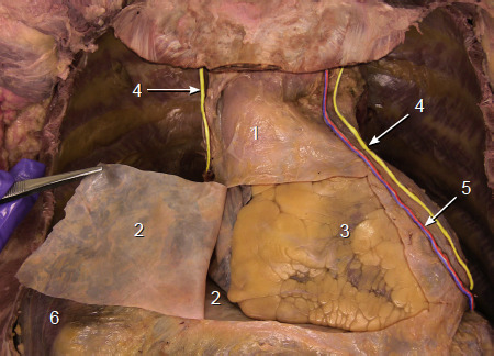 <p>collective covering</p><p></p>