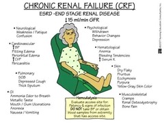 <p>chronic renal failure</p>