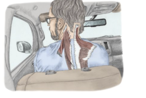 <p>contralateral neck rotation </p>