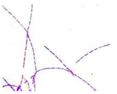 <p><span>What is the shape and arrangement of these bacterial cells?</span></p>