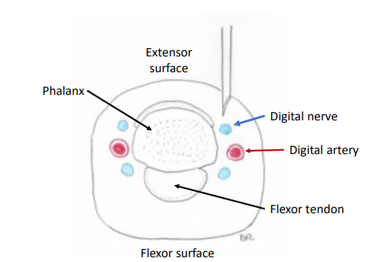 <p>Conventional digital block</p>
