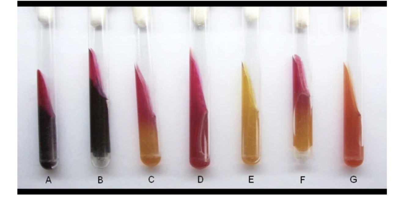 <p>A. Which of the following tests have fermentation? </p><p>B. Which of the following tests have Gas production? </p><p>C. Which of the following tests have Sulfur reduction? </p>