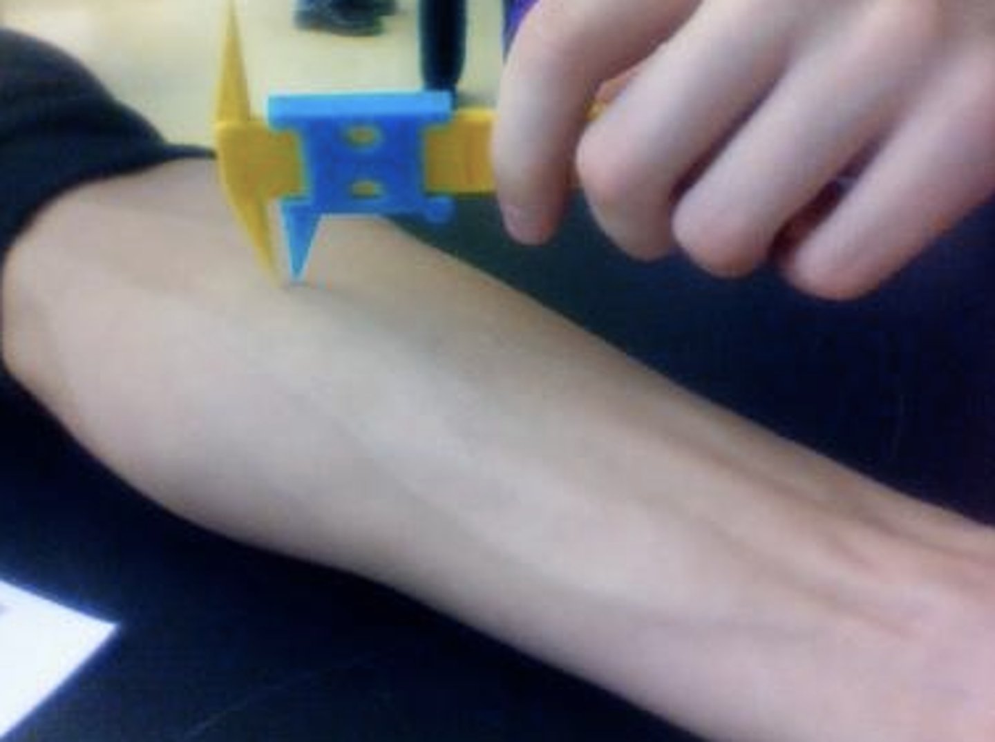 <p>What is the test used to detect receptor fields on the body?</p>