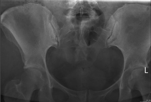 <p>critique for SI joint AP axial </p>
