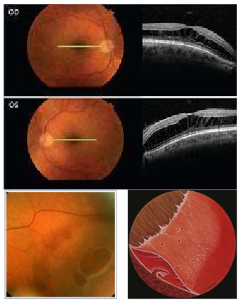 <p>Name the condition</p>