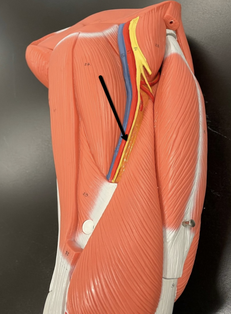 <p><span>Identify the nerve/cord indicated by the pointer.</span></p>