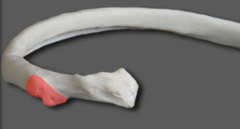 <p>name osseous structure</p>