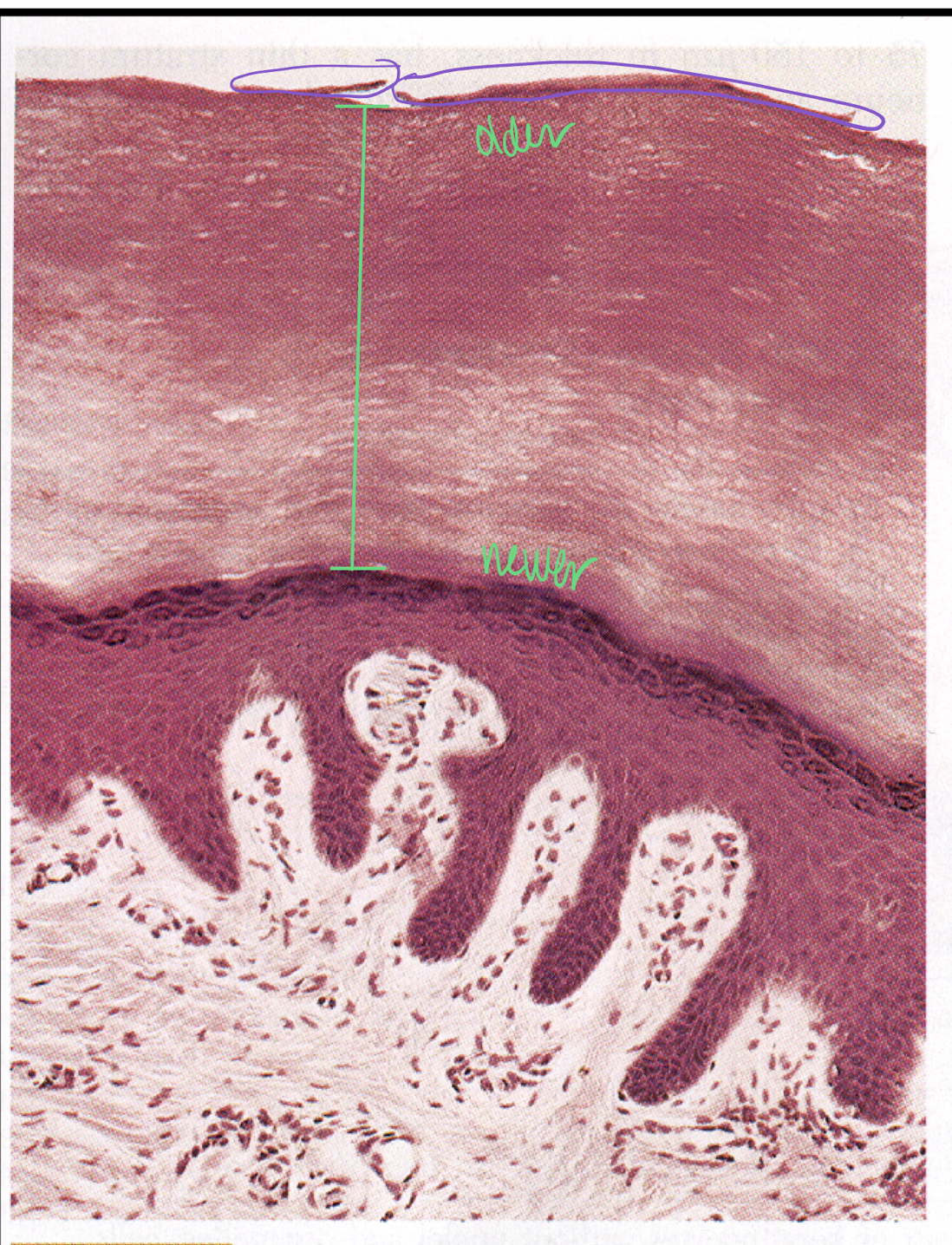 s. corneum - green; desquamation - purple (s. disjunctum)