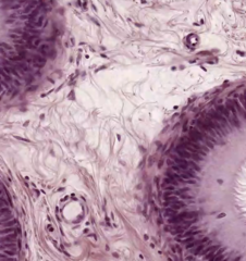 <p>identify the tissue</p>