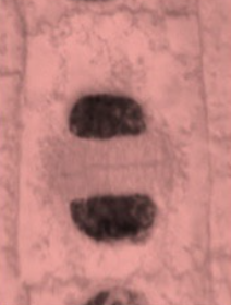 <p>The cell looks like it is undoing the steps of prophase to return to a normal state</p>