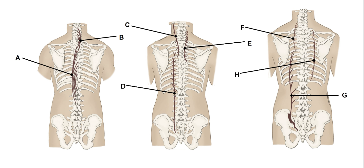<p>Match the appropriate term with the landmark or structure (A-H) identified in the picture below. Answers are used once and there are incorrect choices. NO partial credit.</p>