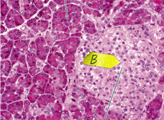 <p>This photomicrograph shows tissue from which gland?</p>
