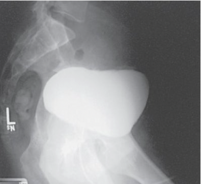 <p>What is this projection?</p>