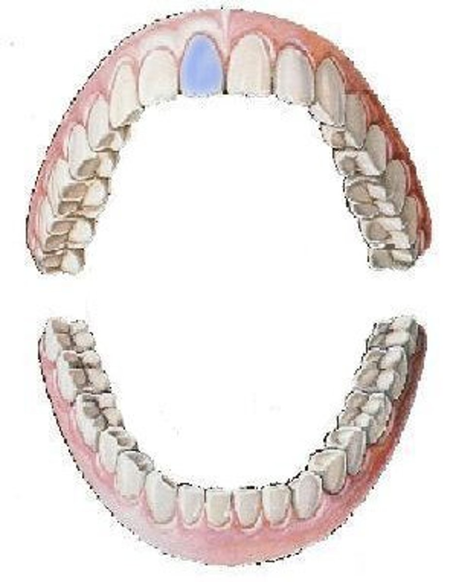<p>maxillary right central incisor</p>