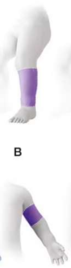 <p>this limb deficiency would be considered ___________</p>