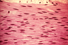 <p>What general type of tissue is this?</p>