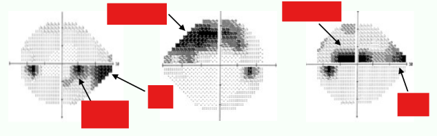 <p>Label the defects:</p>