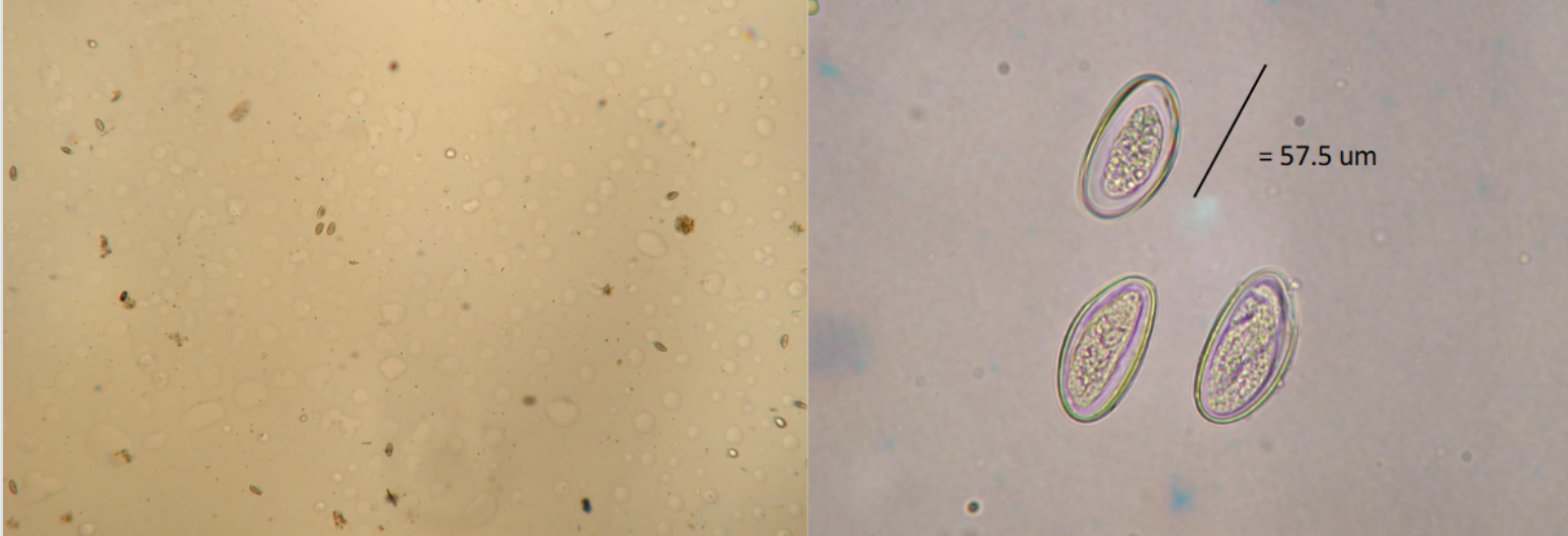 <p>What is the kingdom, phylum, order, and family of this parasite</p>