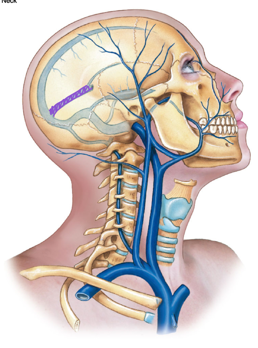 <p>diagram</p>