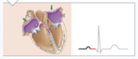 <p>what creates the red line on this image (between the p wave and the QRS wave)</p>