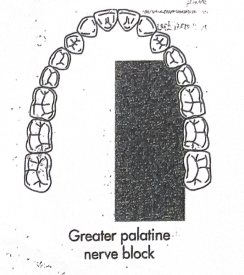 <p>Greater palatine (GP)</p>