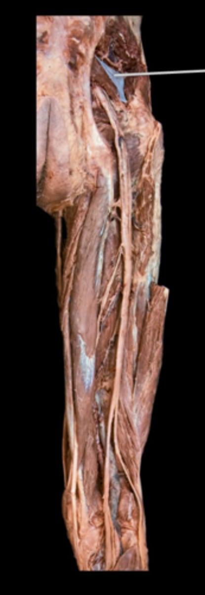 <p>What muscle is this?</p>